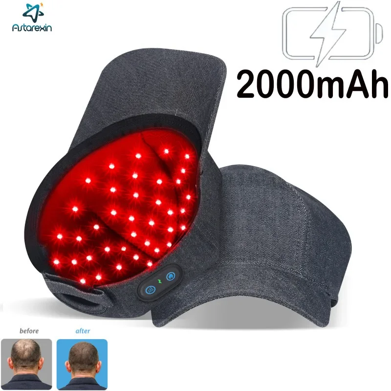 Hair Care Basic - Haargroei Cap Oplaadbare 2000mAh LED Gezondheid