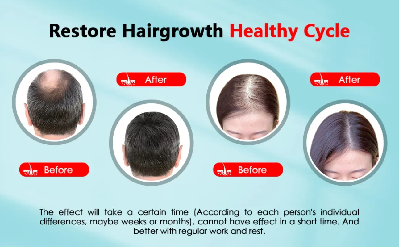 Haargroei Cap Oplaadbare 2000m - Hair Care Basic recensie en prijs